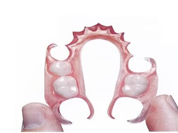 Dental Flexible Partial Dentures Staining Fading Odors Resistant